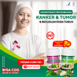 Pengobatan Dengan Herbal Alami Untuk Penyakit Kanker yang Sudah Menyebar